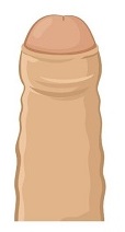 日本における包茎に対する考え方